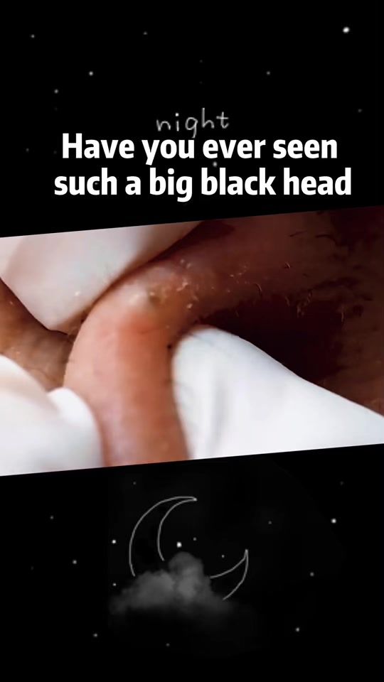 TikTok video thumbnail by svtdocto