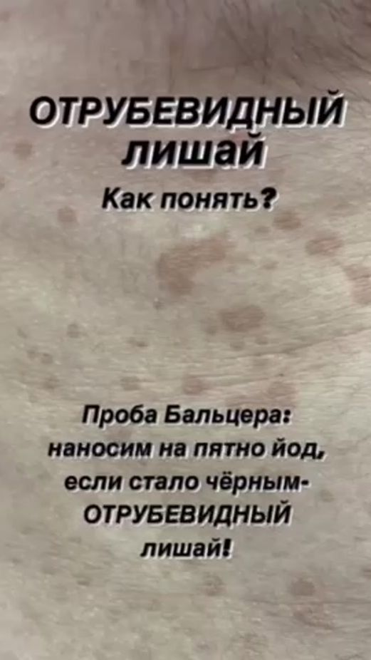 TikTok video thumbnail by dr.emiheeva