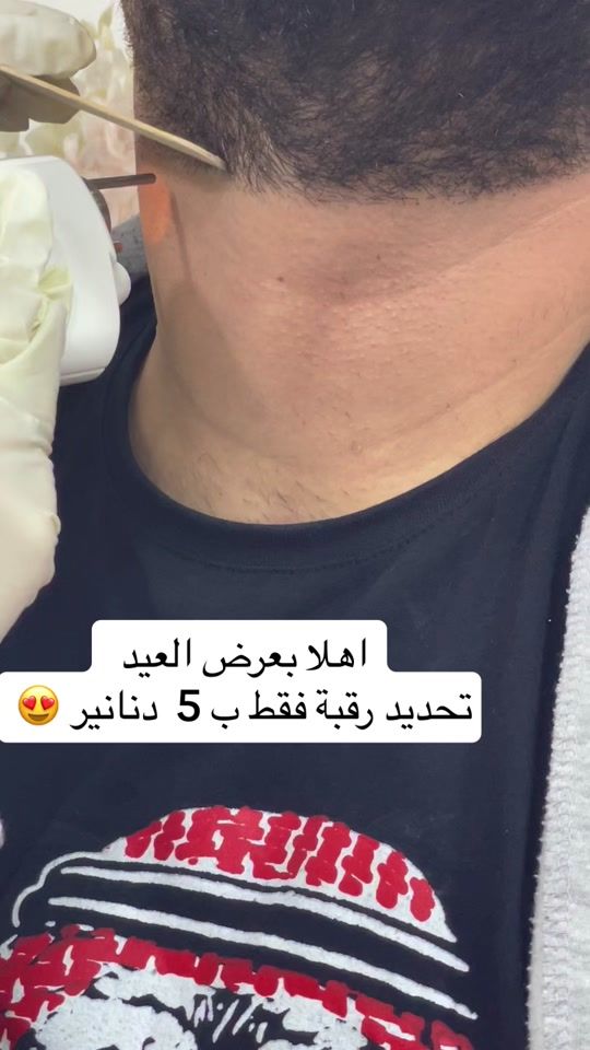 TikTok video thumbnail by gloria.clinic