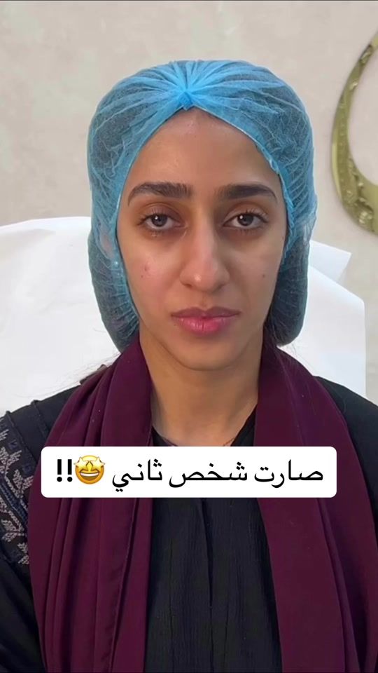 TikTok video thumbnail by mozdanhclinic