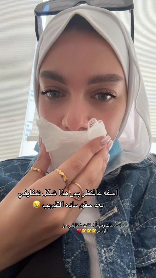 TikTok video thumbnail by noonii.aladly
