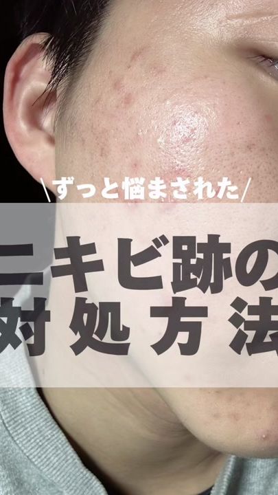 TikTok video thumbnail by i_am_kosuke1998