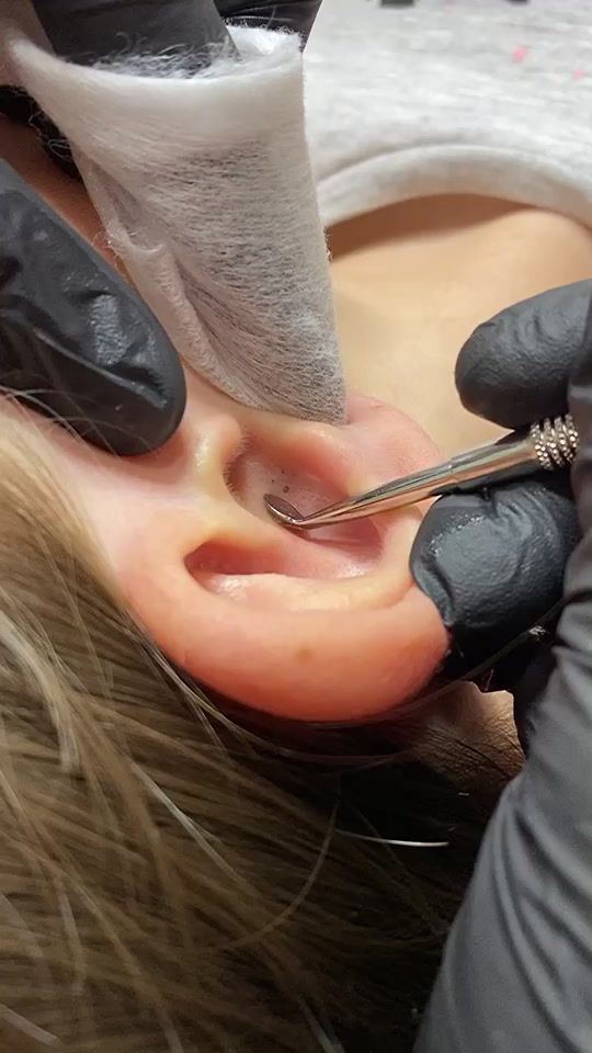 TikTok video thumbnail by cosmetolog_26_15