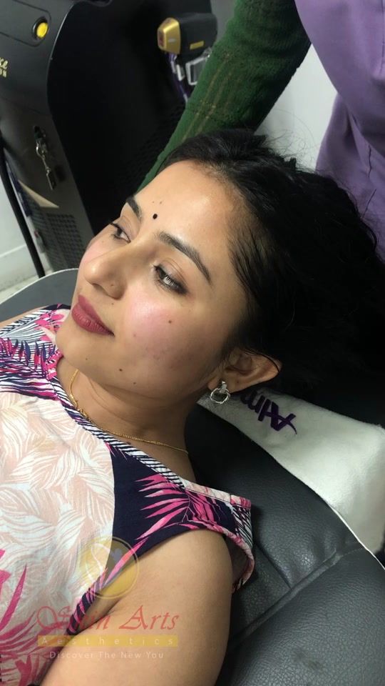 TikTok video thumbnail by skinartsnepal