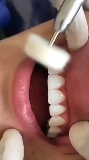 TikTok video thumbnail by moradjamal22