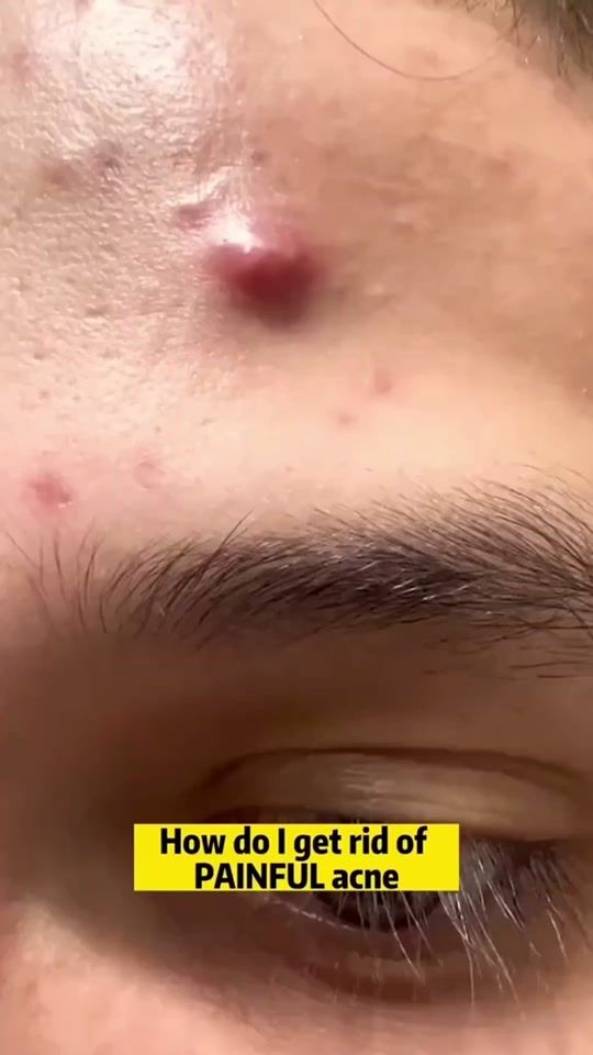 TikTok video thumbnail by gracebeelee
