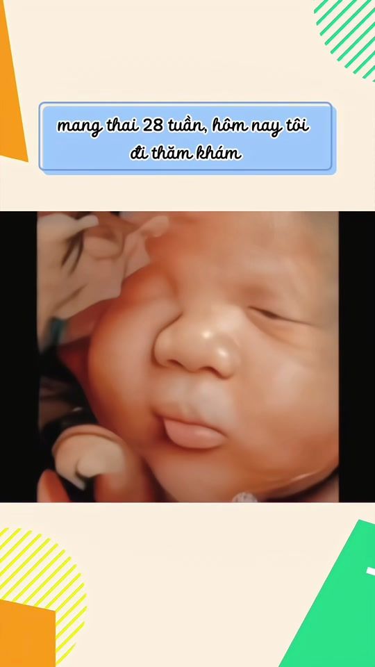 TikTok video thumbnail by hongvinh6868