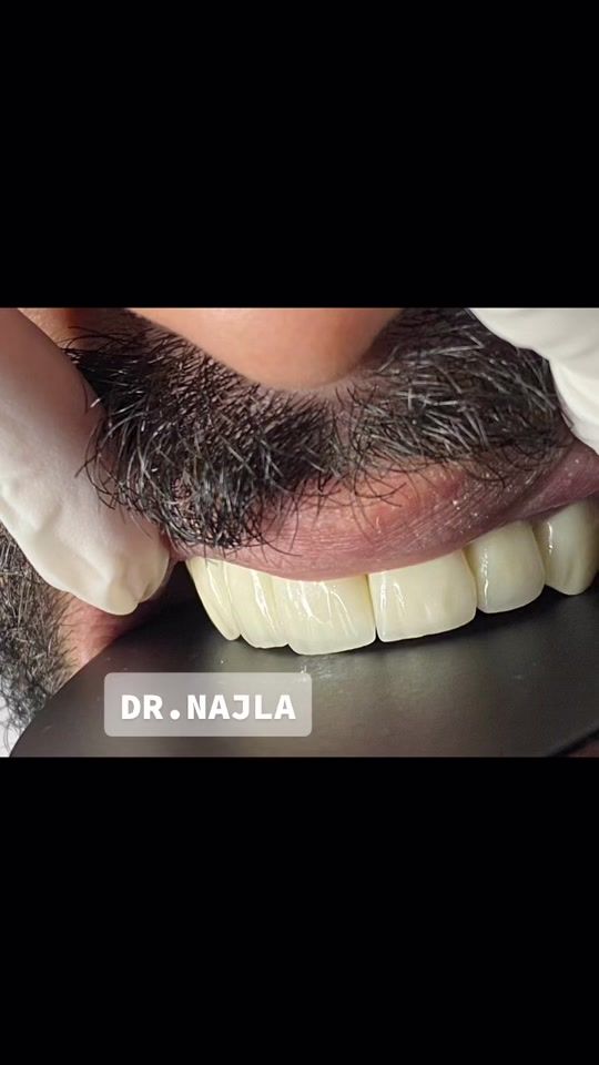 TikTok video thumbnail by drnajla
