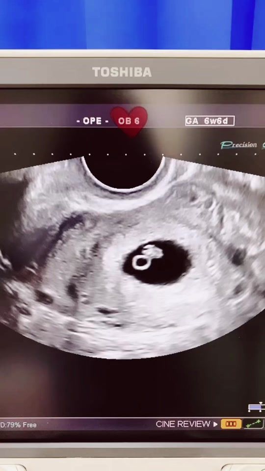 TikTok video thumbnail by doc.rubtsova