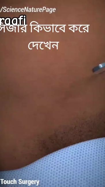 TikTok video thumbnail by siam15700