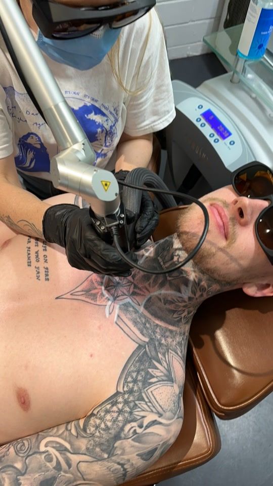 TikTok video thumbnail by swlasertattooremoval