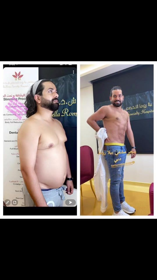 TikTok video thumbnail by dr.beverlyhills