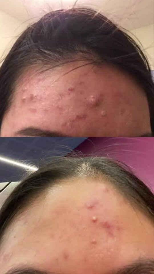 TikTok video thumbnail by kiarrareyes