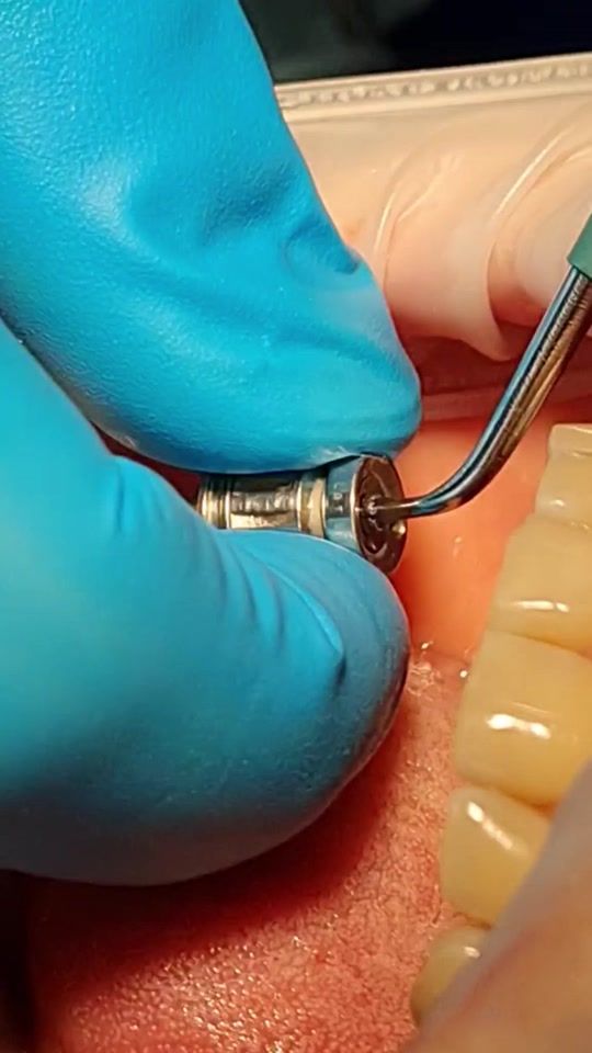 TikTok video thumbnail by doctor.moskalev