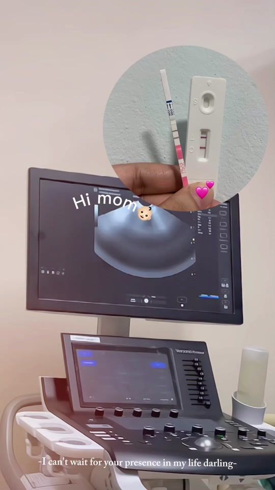 TikTok video thumbnail by aor.ppl