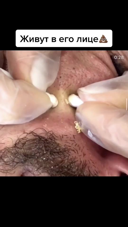TikTok video thumbnail by merzkoetv