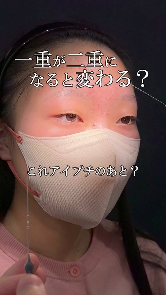 TikTok video thumbnail by dr_riku.ikeda