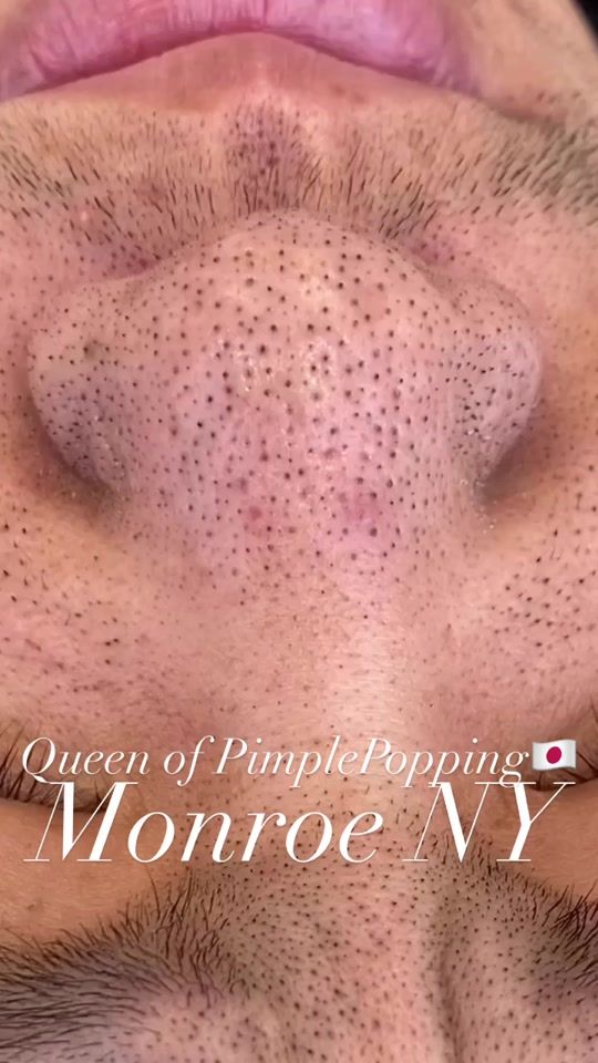 TikTok video thumbnail by monroe_ny