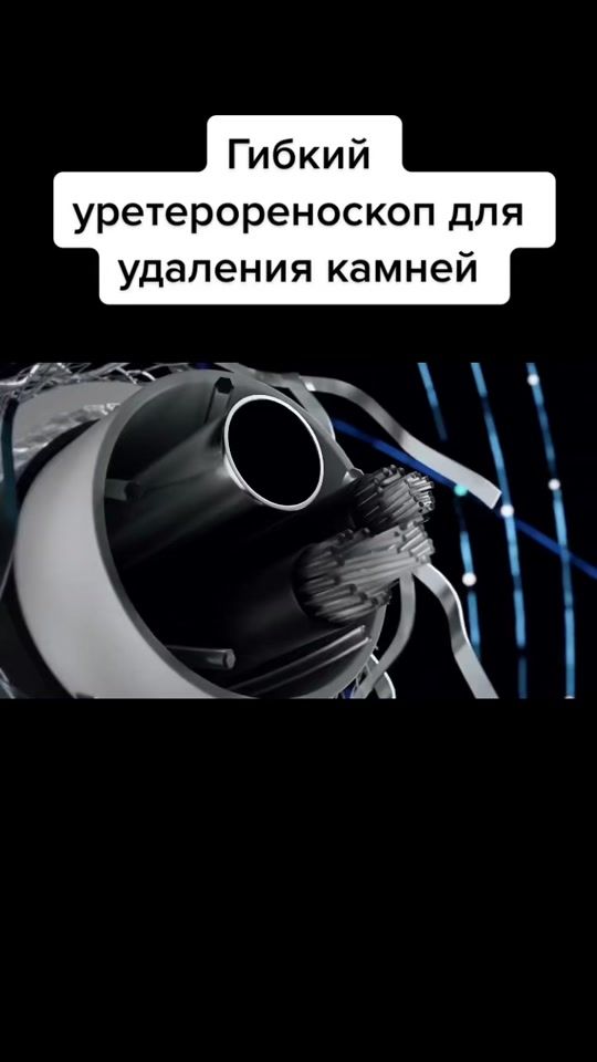 TikTok video thumbnail by doctor_davydov