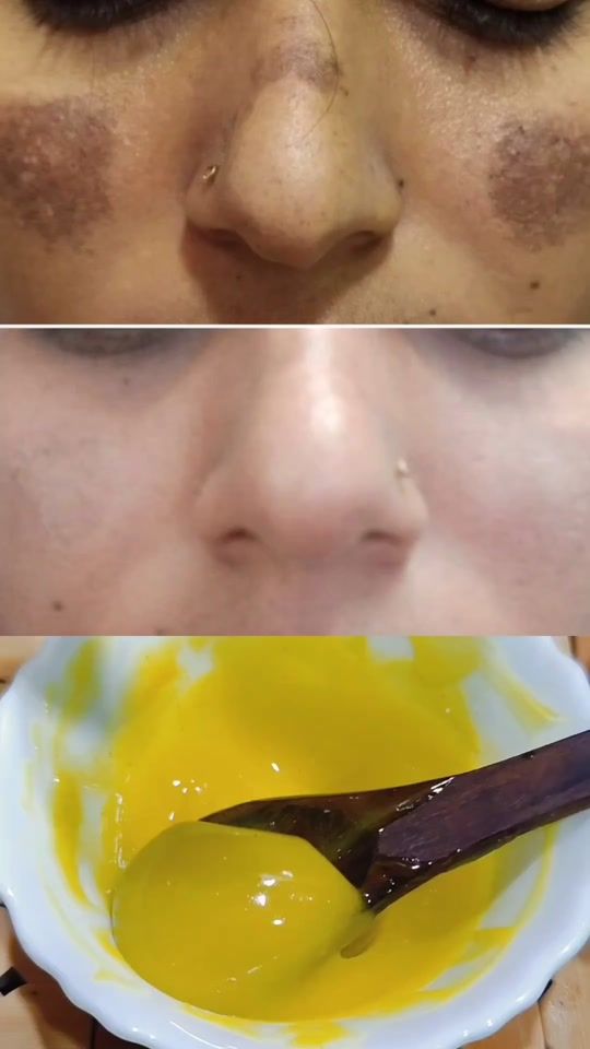 TikTok video thumbnail by veeraayurveda