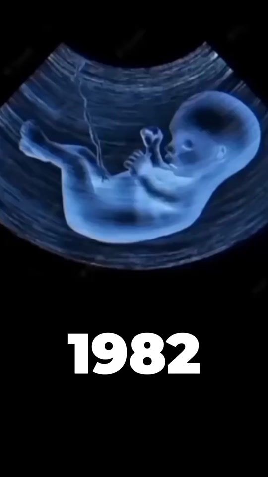 TikTok video thumbnail by binhamiz