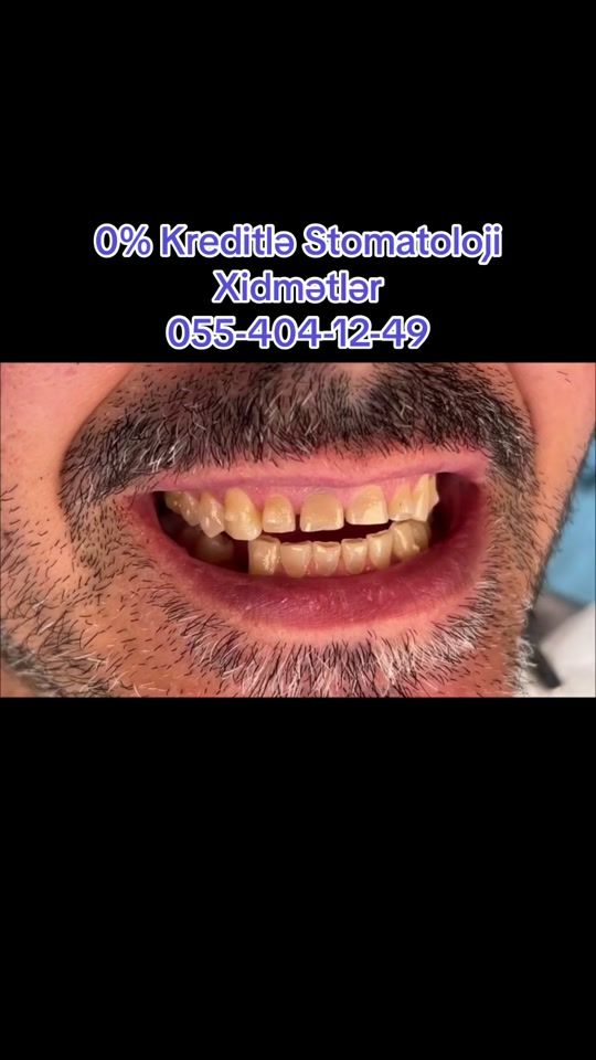 TikTok video thumbnail by estetic_dental
