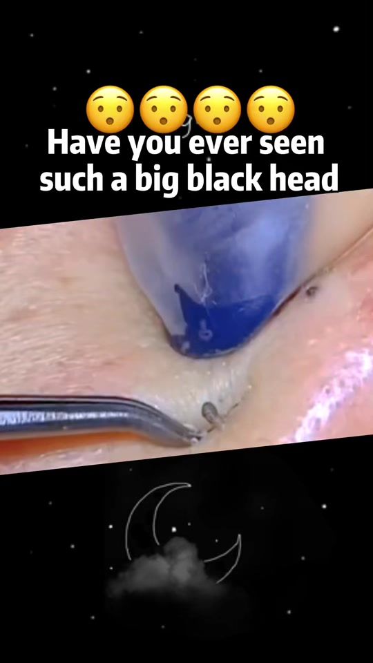 TikTok video thumbnail by svtdocto