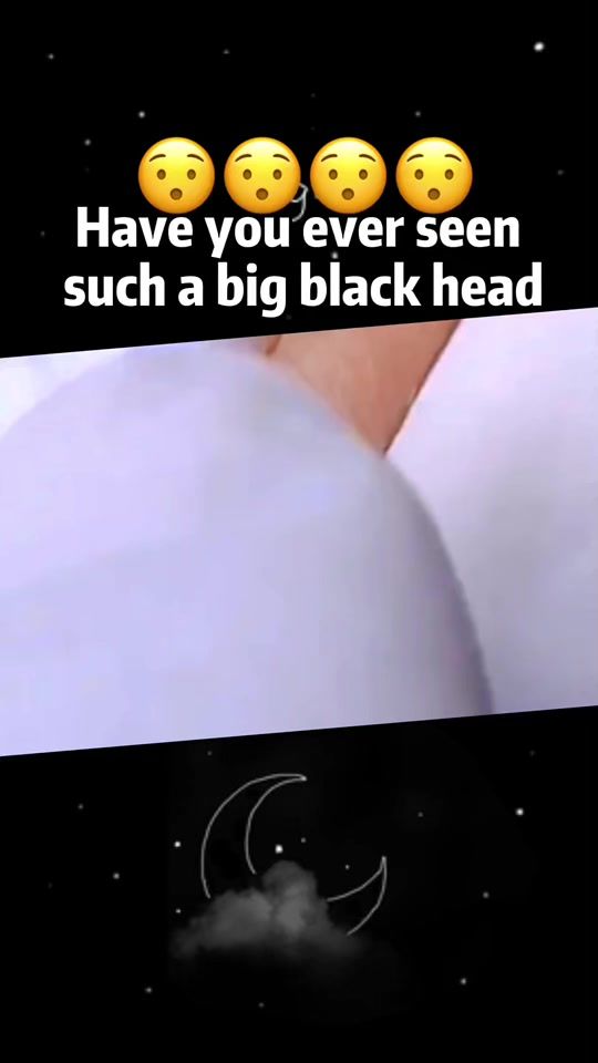 TikTok video thumbnail by svtdocto