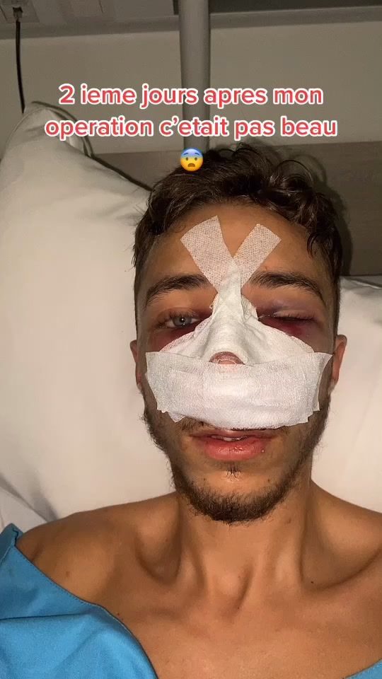 TikTok video thumbnail by ti_ryaan