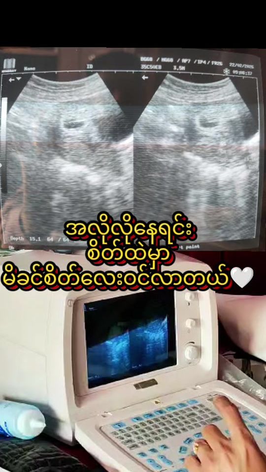 TikTok video thumbnail by khin1422019