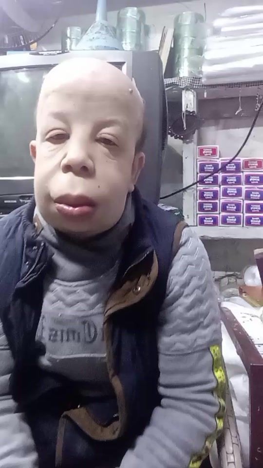 TikTok video thumbnail by hossam_bogy_