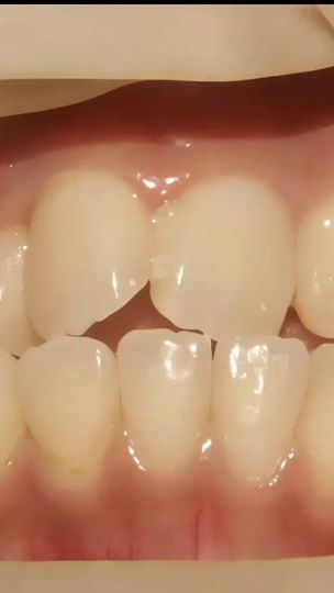 TikTok video thumbnail by yesbangphli.dc