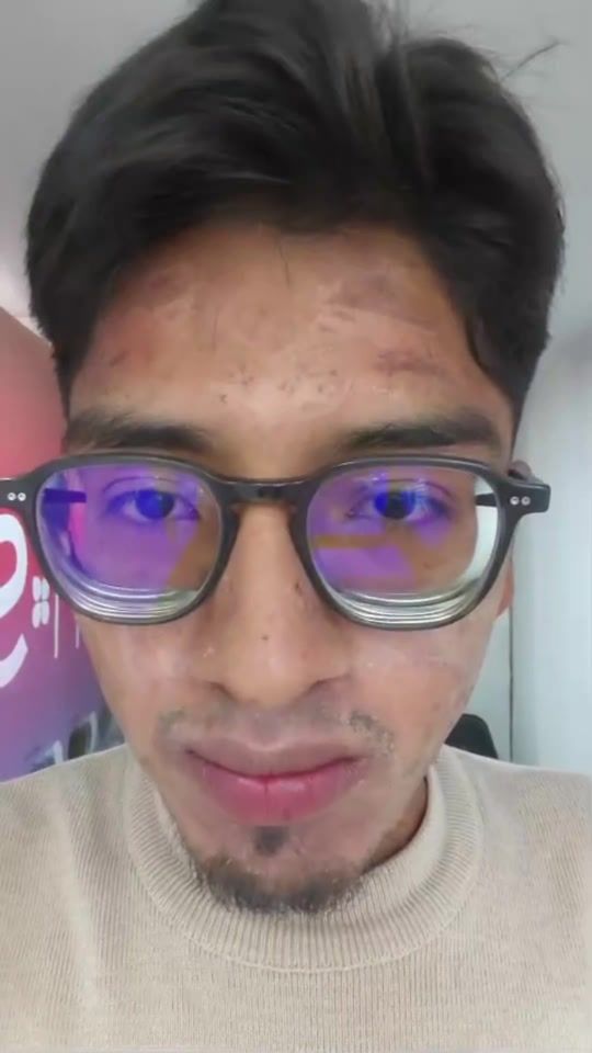 TikTok video thumbnail by sandsplazaspa