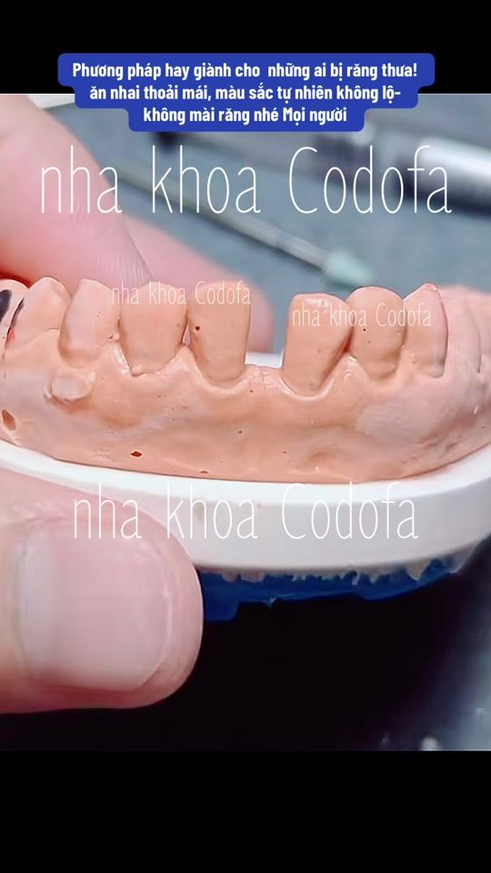 TikTok video thumbnail by nhakhoa_codofa
