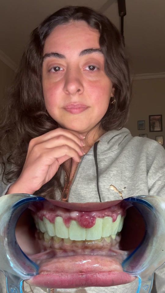TikTok video thumbnail by dr_alaaayman