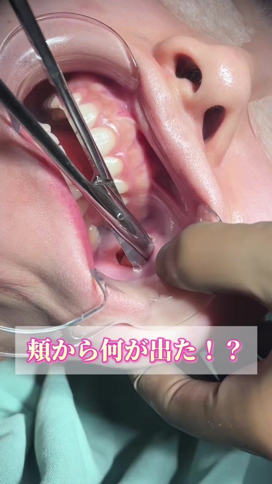 TikTok video thumbnail by dr.nakanishi
