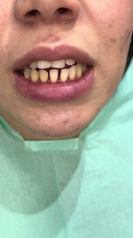 TikTok video thumbnail by dr_safa_habibi
