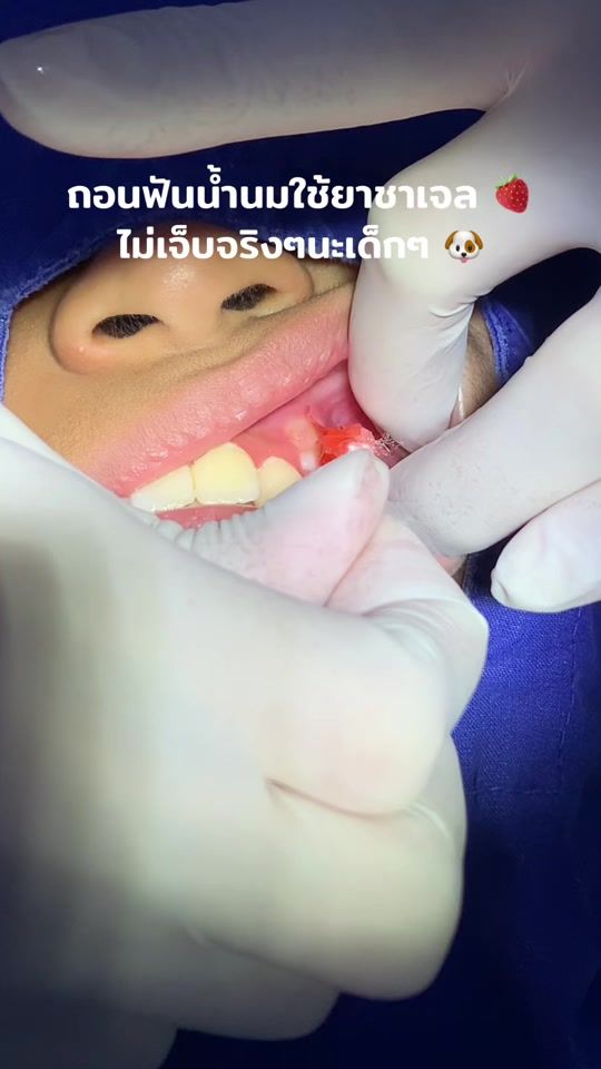 TikTok video thumbnail by hugyim_dental
