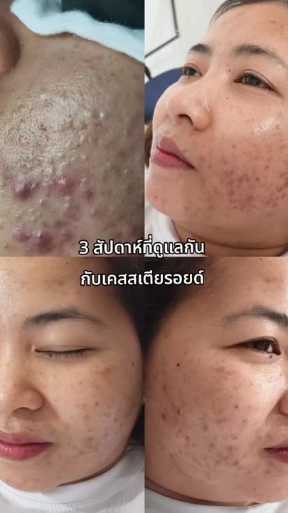 TikTok video thumbnail by ging_kotsew