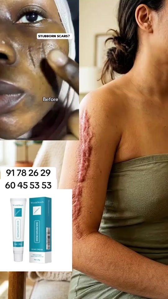 TikTok video thumbnail by ecommerce.birra.a