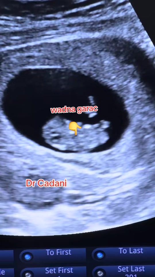 TikTok video thumbnail by drcadani