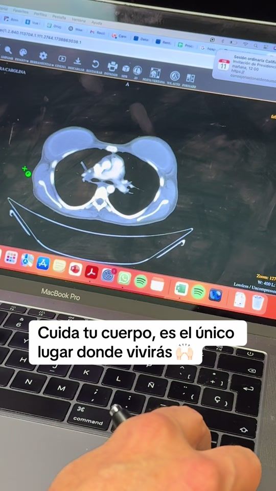 TikTok video thumbnail by soygrillosadda