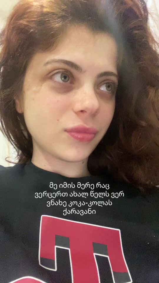 TikTok video thumbnail by ganogerliani