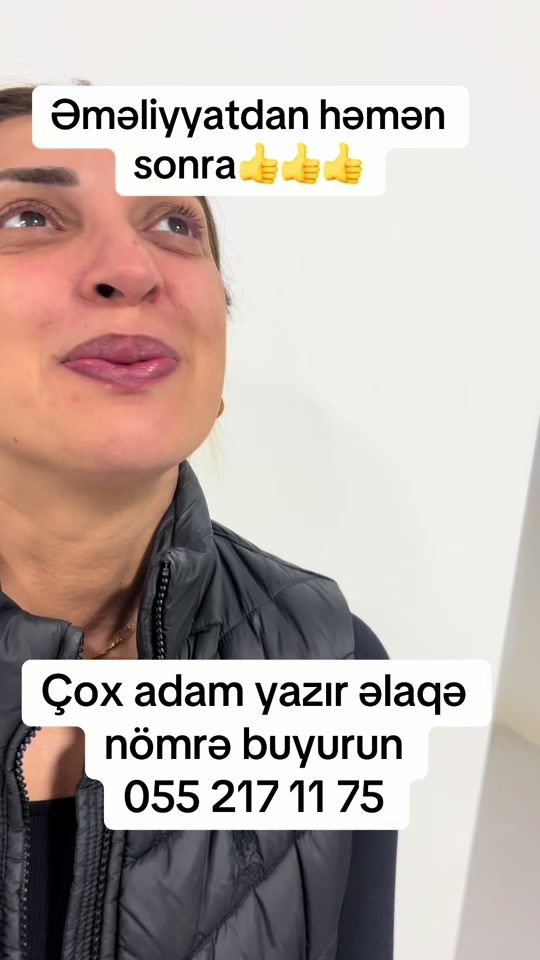 TikTok video thumbnail by dr.rino.med