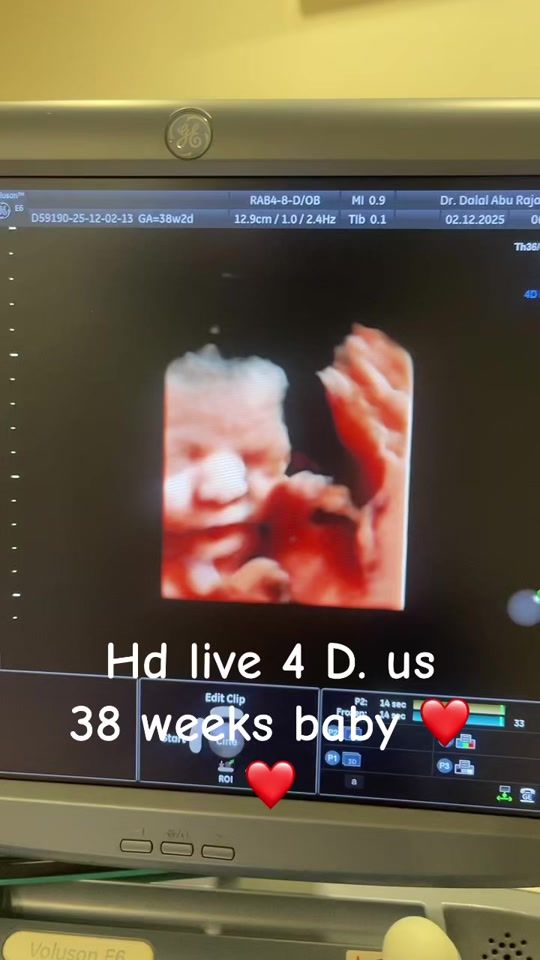 TikTok video thumbnail by dr.dalal.aburajab