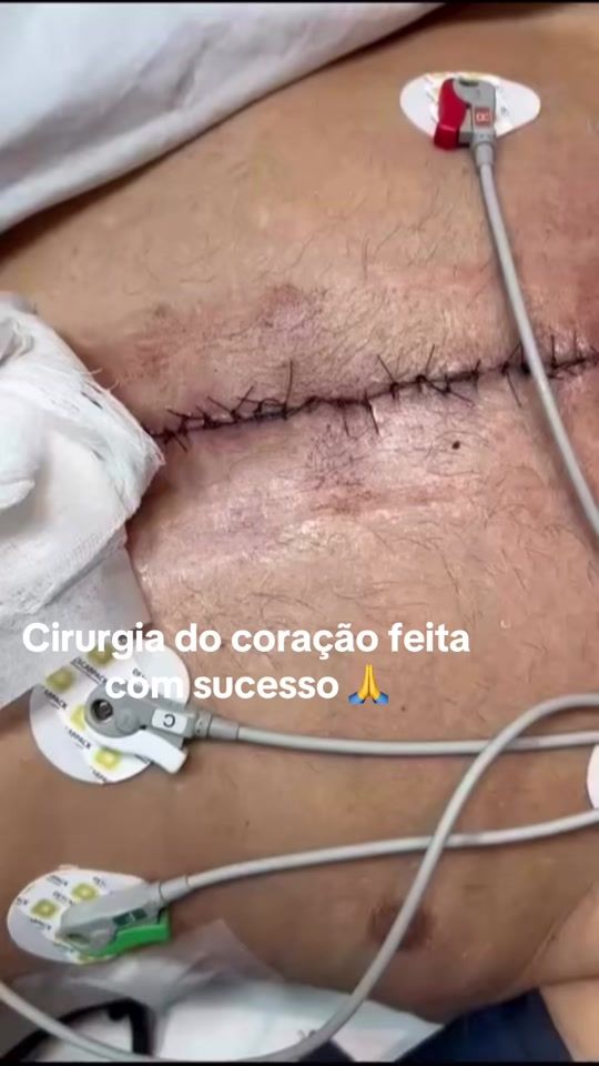 TikTok video thumbnail by dra_cleo