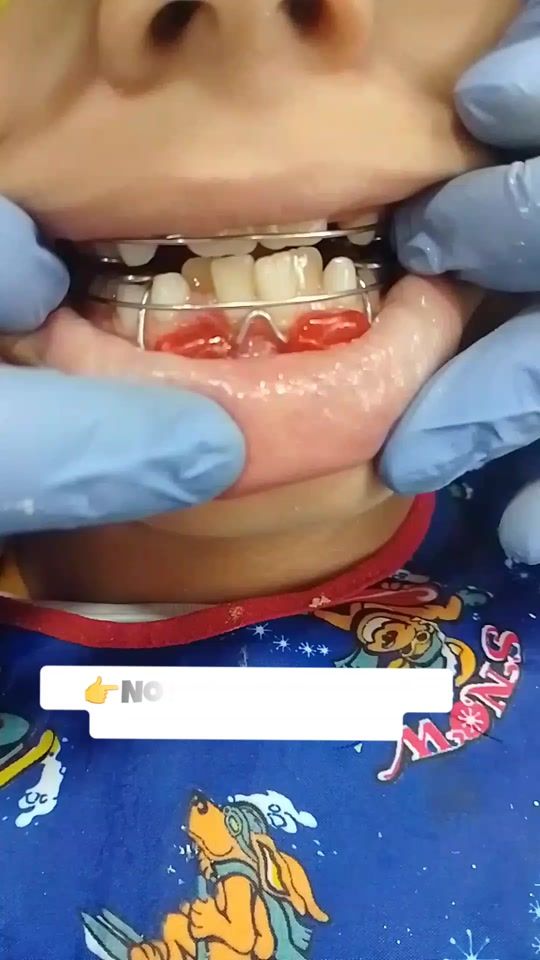 TikTok video thumbnail by escudental
