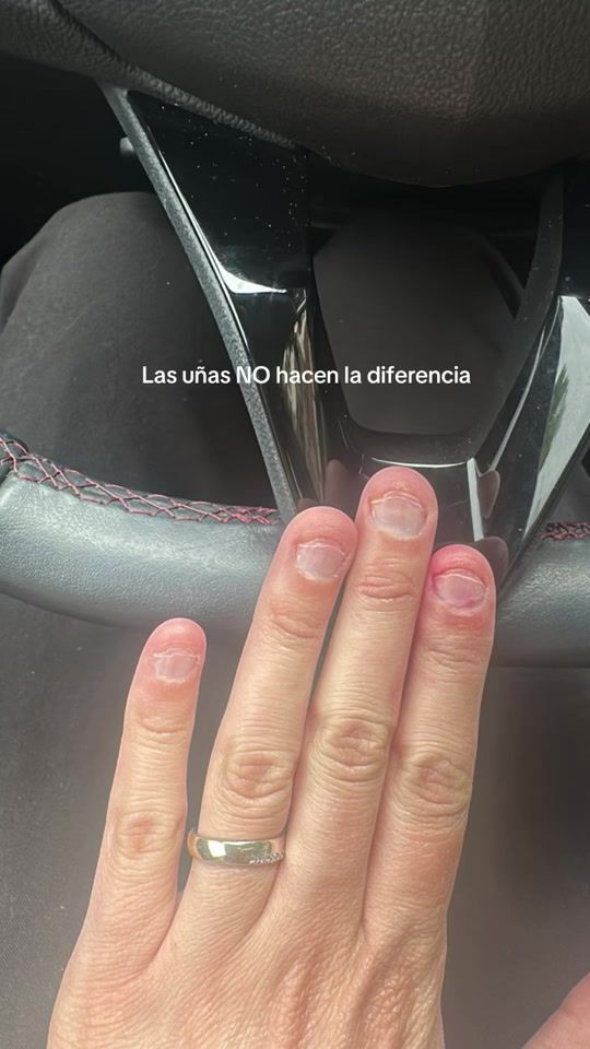 TikTok video thumbnail by belen_snails