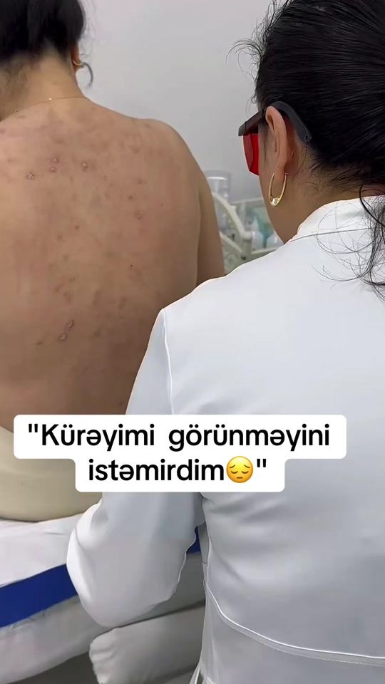TikTok video thumbnail by dermatoloq_feride
