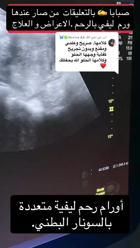 TikTok video thumbnail by dr.nidalabouradi1